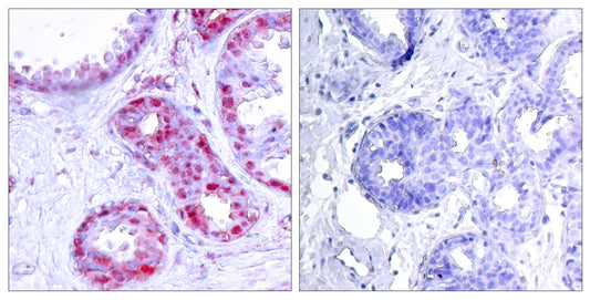 AP-1 (phospho Ser243) Rabbit Polyclonal Antibody