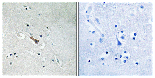 APLP2 (phospho Tyr755) Rabbit Polyclonal Antibody