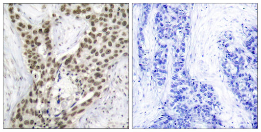 AR (phospho Ser213) Rabbit Polyclonal Antibody