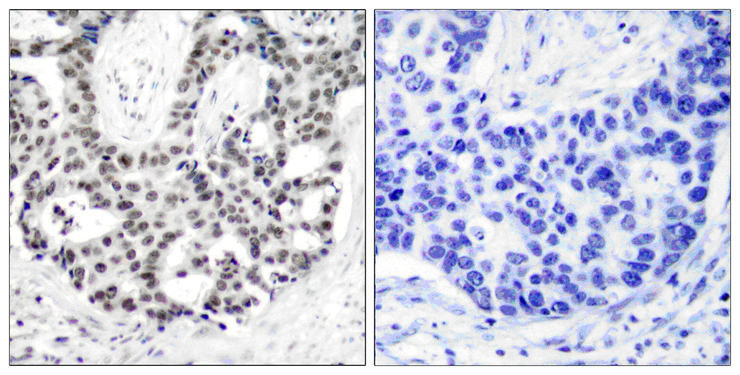 AR (phospho Ser650) Rabbit Polyclonal Antibody