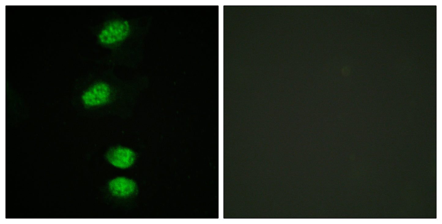 AR (phospho Ser94) Rabbit Polyclonal Antibody