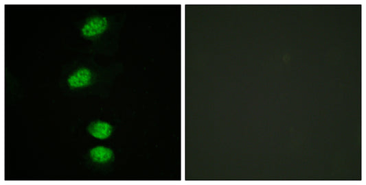 AR (phospho Ser94) Rabbit Polyclonal Antibody