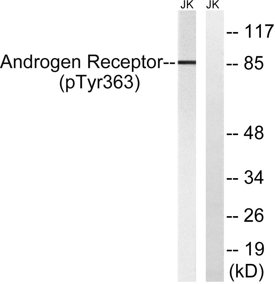 AR (phospho Tyr363) Rabbit Polyclonal Antibody