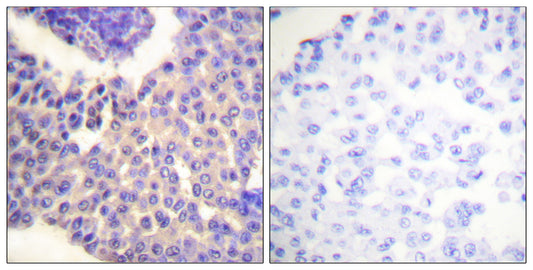 Arrestin-β-1 (phospho Ser412) Rabbit Polyclonal Antibody