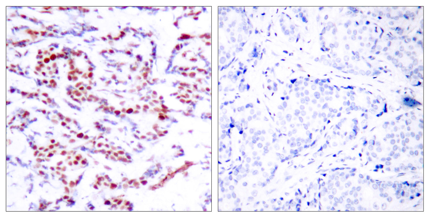 ATF-2 (phospho Ser112) Rabbit Polyclonal Antibody
