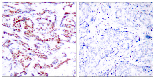 ATF-2 (phospho Ser112) Rabbit Polyclonal Antibody