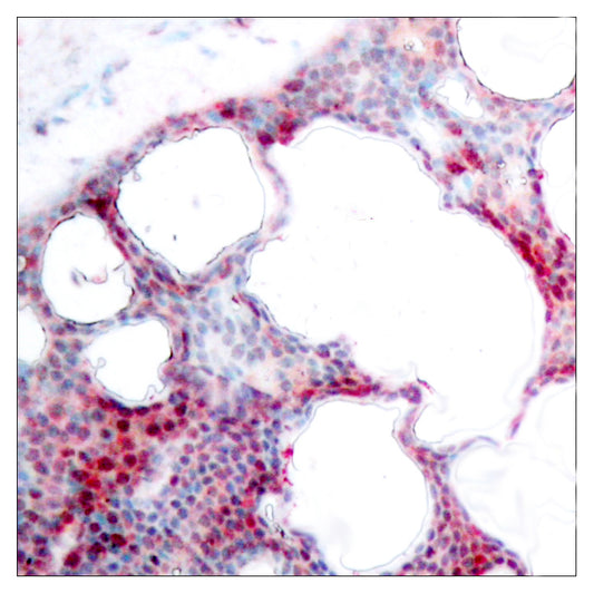 ATF-2 (phospho Ser62) Rabbit Polyclonal Antibody
