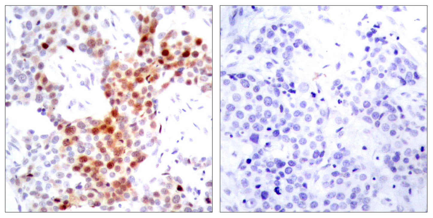 ATF-2 (phospho Thr69) Rabbit Polyclonal Antibody