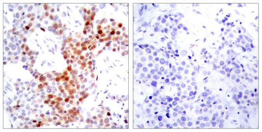 ATF-2 (phospho Thr69) Rabbit Polyclonal Antibody