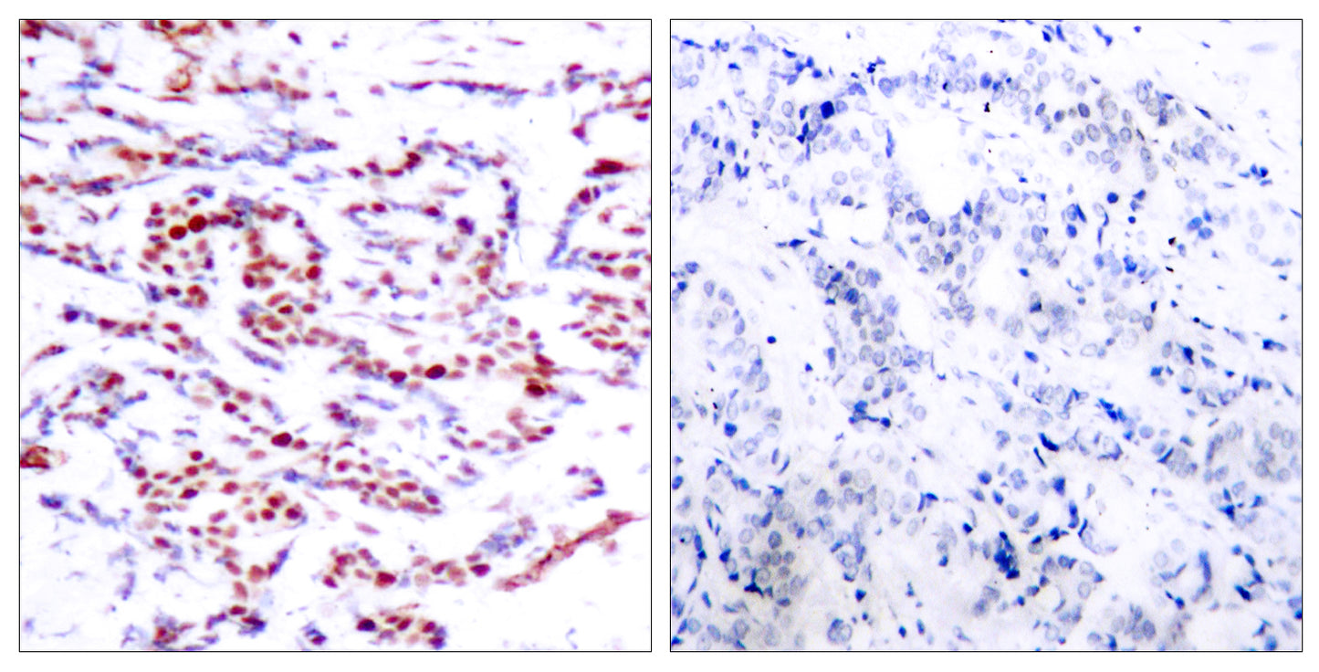 ATF-2 (phospho Thr71) Rabbit Polyclonal Antibody