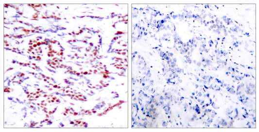 ATF-2 (phospho Thr71) Rabbit Polyclonal Antibody