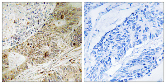 ATRIP (phospho Ser224) Rabbit Polyclonal Antibody