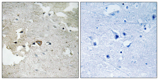 Axl (phospho Tyr691) Rabbit Polyclonal Antibody