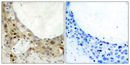 Bcl-2 (phospho Ser70) Rabbit Polyclonal Antibody