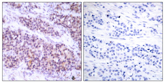 Bcl-x (phospho Ser62) Rabbit Polyclonal Antibody