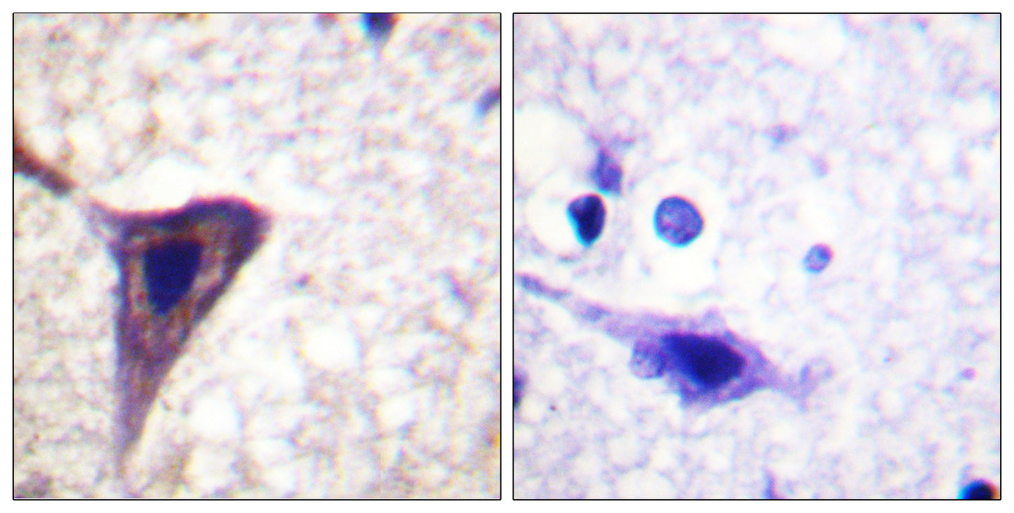BID (phospho Ser78) Rabbit Polyclonal Antibody