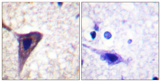 BID (phospho Ser78) Rabbit Polyclonal Antibody