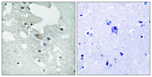 BLNK (phospho Tyr84) Rabbit Polyclonal Antibody