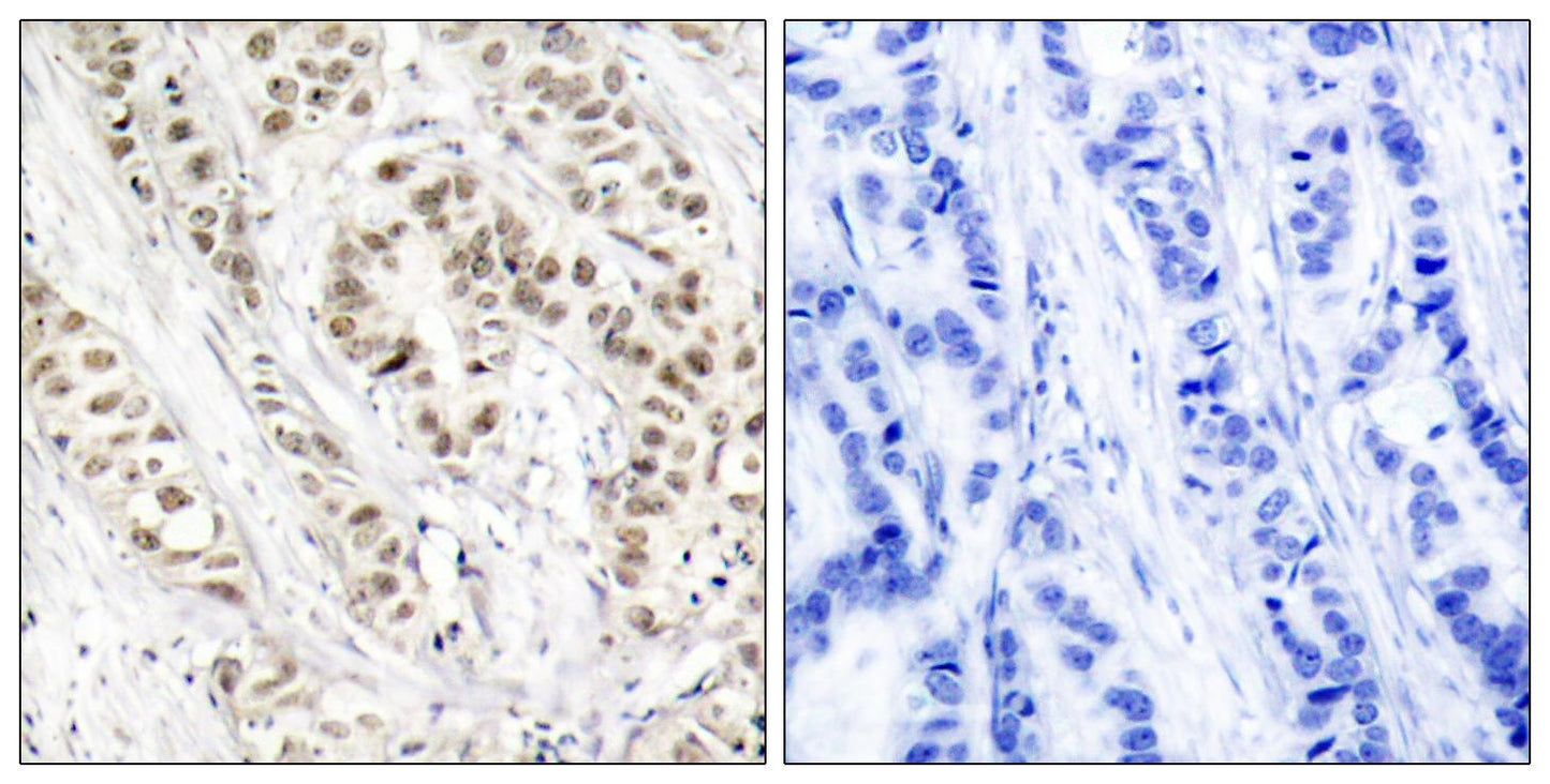 BRCA1 (phospho Ser1524) Rabbit Polyclonal Antibody