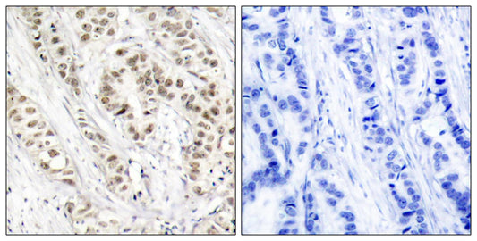 BRCA1 (phospho Ser1524) Rabbit Polyclonal Antibody