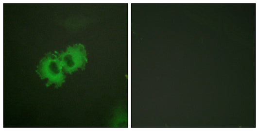 Caldesmon (phospho Ser789) Rabbit Polyclonal Antibody