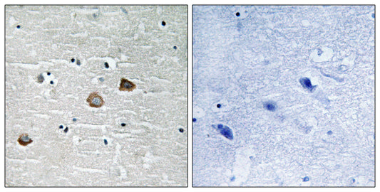 CaMKIIβ/γ/δ (phospho Thr287) Rabbit Polyclonal Antibody