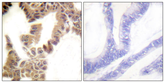 Caspase-2 (phospho Ser157) Rabbit Polyclonal Antibody
