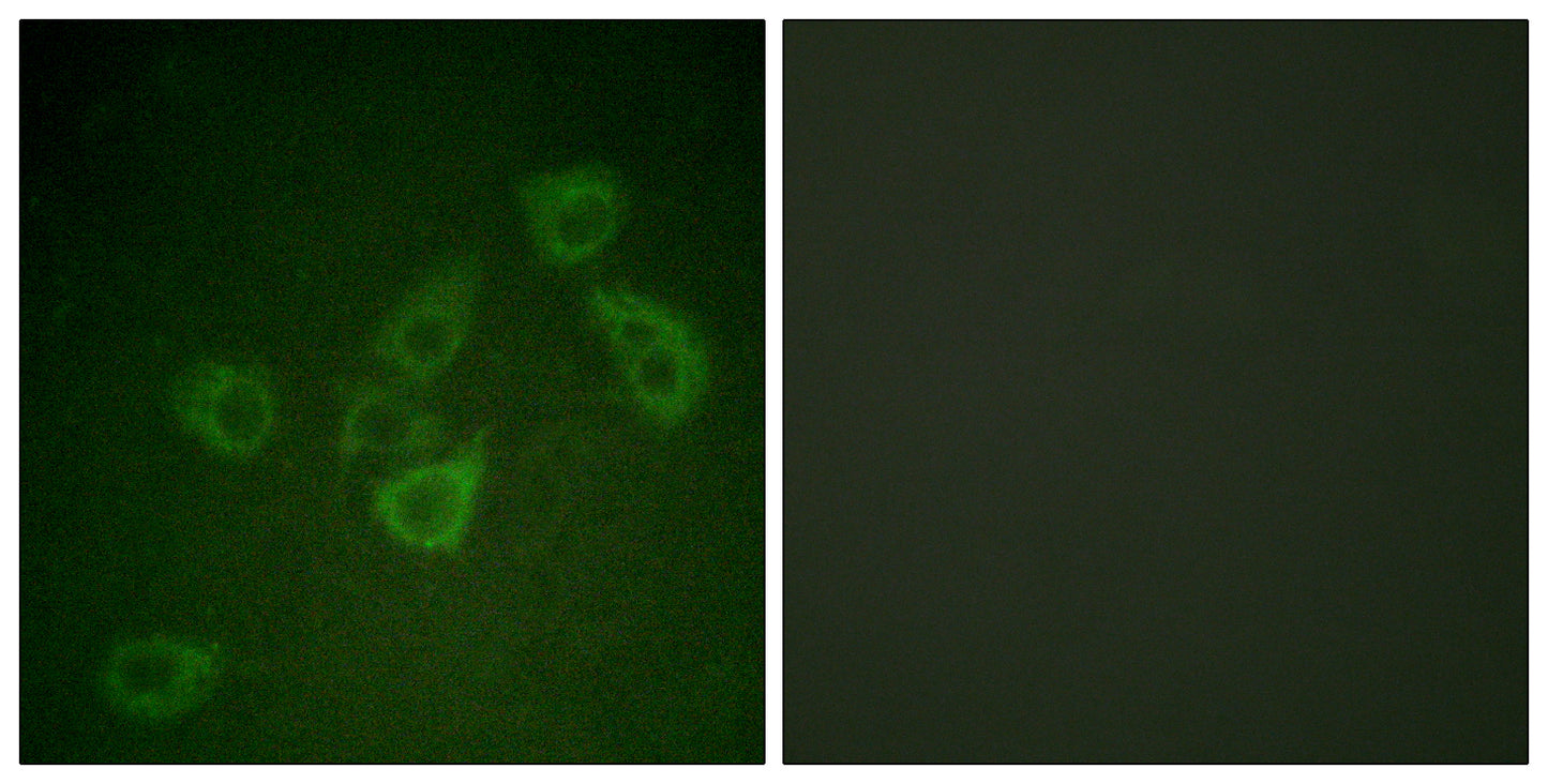 Caspase-6 (phospho Ser257) Rabbit Polyclonal Antibody