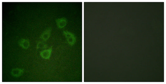 Caspase-6 (phospho Ser257) Rabbit Polyclonal Antibody