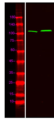Catenin δ-1 (phospho-Tyr904) Rabbit Polyclonal Antibody