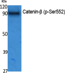 Catenin-β (phospho Ser552) Rabbit Polyclonal Antibody