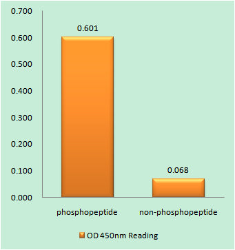 Catenin-β (phospho Tyr489) Rabbit Polyclonal Antibody