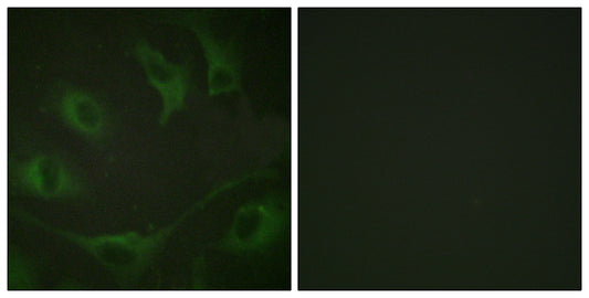 Cbl (phospho Tyr774) Rabbit Polyclonal Antibody