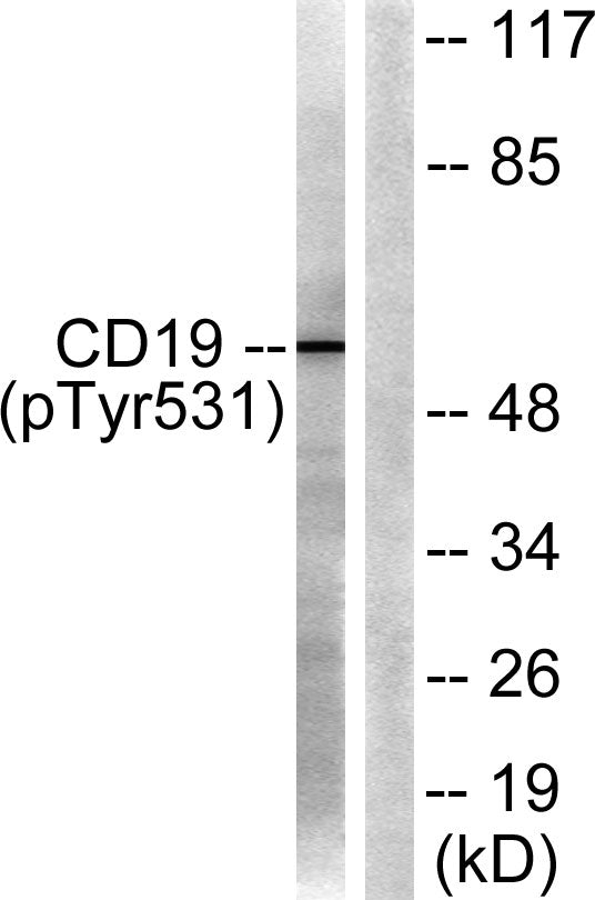 CD19 (phospho Tyr531) Rabbit Polyclonal Antibody