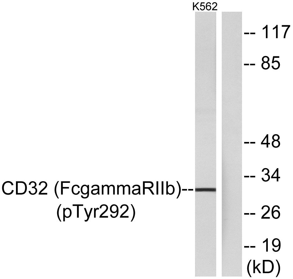 CD32 (phospho Tyr292) Rabbit Polyclonal Antibody