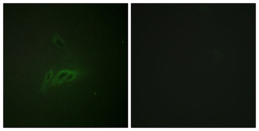 CD45 (phospho Ser1007) Rabbit Polyclonal Antibody