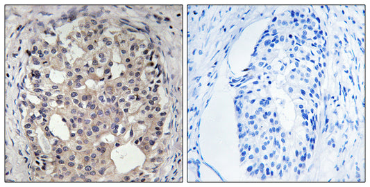 Cdc25A (phospho Ser178) Rabbit Polyclonal Antibody