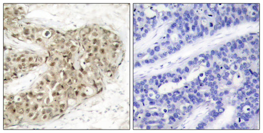 Cdc25C (phospho Ser216) Rabbit Polyclonal Antibody