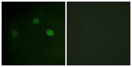 Cdk1/2/3 (phospho Thr14) Rabbit Polyclonal Antibody