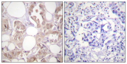 Cdk7 (phospho Thr170) Rabbit Polyclonal Antibody