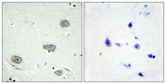 c-Fms (phospho Tyr809) Rabbit Polyclonal Antibody