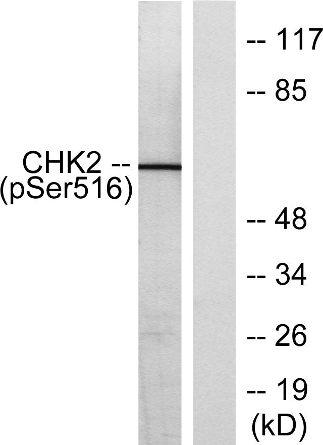 Chk2 (phospho Ser516) Rabbit Polyclonal Antibody