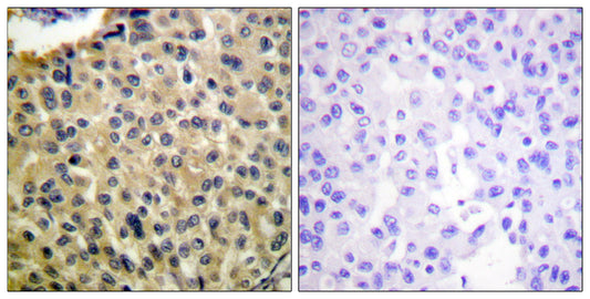 c-Kit (phospho Tyr703) Rabbit Polyclonal Antibody