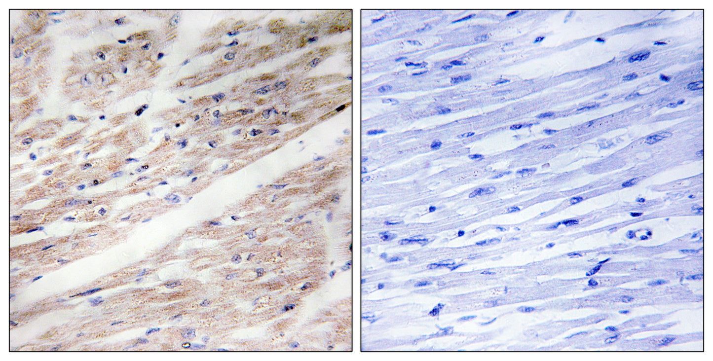 c-Kit (phospho Tyr936) Rabbit Polyclonal Antibody