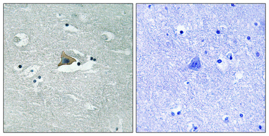 Claudin-5 (phospho Tyr217) Rabbit Polyclonal Antibody