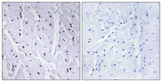 c-Myb (phospho Ser12) Rabbit Polyclonal Antibody
