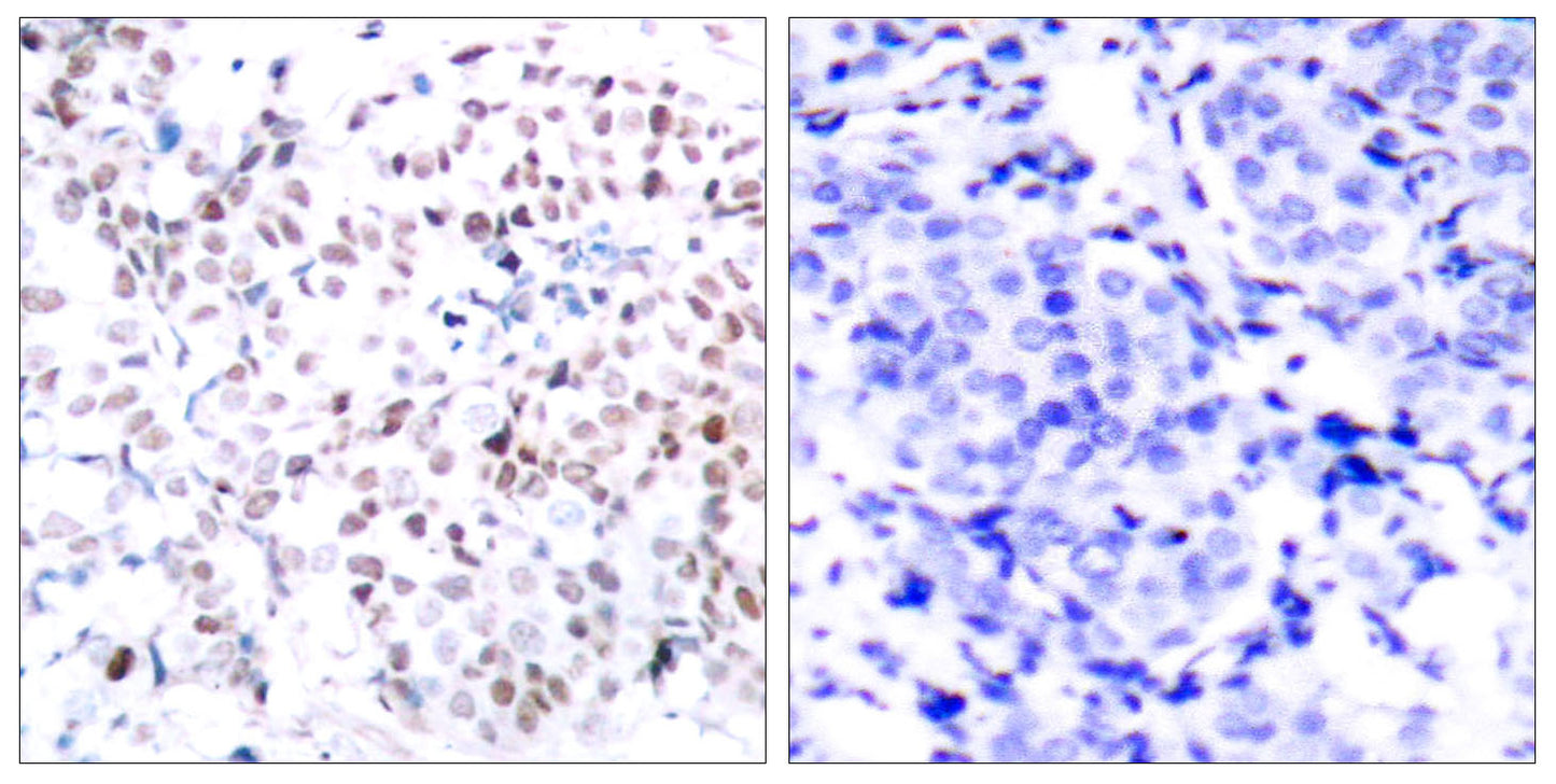 c-Myc (phospho Thr358) Rabbit Polyclonal Antibody