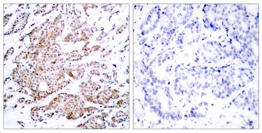 c-Myc (phospho Thr58) Rabbit Polyclonal Antibody