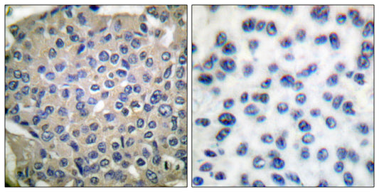 Cortactin (phospho Tyr466) Rabbit Polyclonal Antibody
