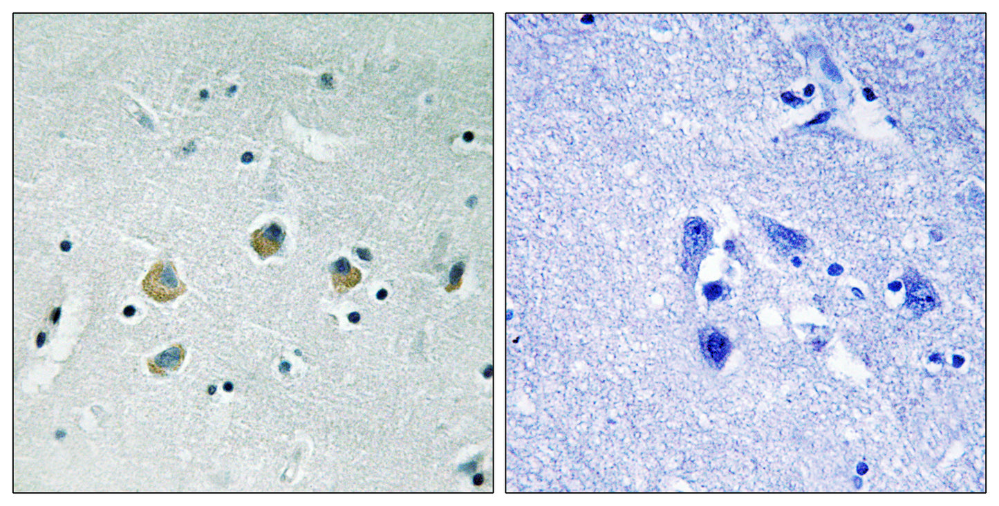 Cot (phospho Ser400) Rabbit Polyclonal Antibody